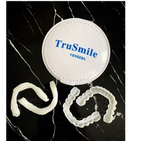 لمینت متحرک دندان دو فک ترو اسمایل Tru Smile